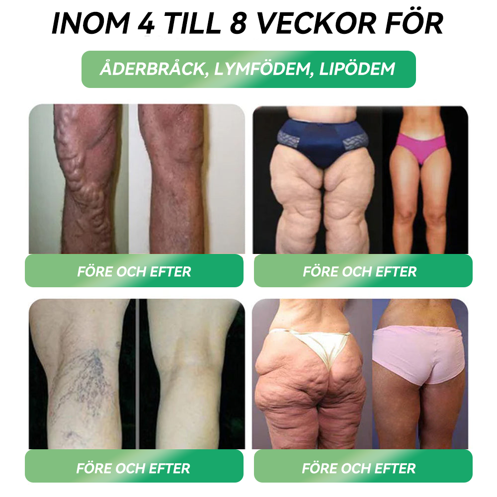 𝐋𝗲𝗿𝗰𝗲𝗮® 🔥Under en begränsad tid kan du spara 70% på din andra beställning🔥