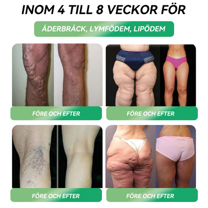 𝐋𝗲𝗿𝗰𝗲𝗮® 🔥Under en begränsad tid kan du spara 70% på din andra beställning🔥