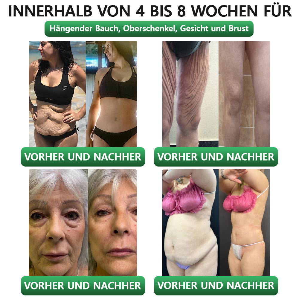 30 % Rabatt | 👩‍⚕️ 𝗟𝗲𝗿𝗰𝗲𝗮® 𝗚𝗟𝗣-𝟭 & 𝗠𝗮𝘁𝗿𝗶𝘅𝘆𝗹 3000 7-in-1 Body Balance Gesundheit–Lösung zum Einnehmen Für Fettleibigkeit, schlaffe Haut, Herz-Kreislauf-Gesundheit, Diabetes, Schlafapnoe, Gelenkprobleme usw.