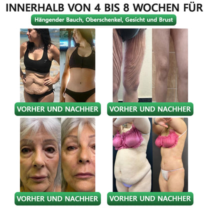 30 % Rabatt | 👩‍⚕️ 𝗟𝗲𝗿𝗰𝗲𝗮® 𝗚𝗟𝗣-𝟭 & 𝗠𝗮𝘁𝗿𝗶𝘅𝘆𝗹 3000 7-in-1 Body Balance Gesundheit–Lösung zum Einnehmen Für Fettleibigkeit, schlaffe Haut, Herz-Kreislauf-Gesundheit, Diabetes, Schlafapnoe, Gelenkprobleme usw.