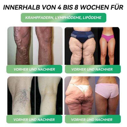 【Lercea®】Profitiere von 30 % Rabatt auf deine zweite Bestellung✅